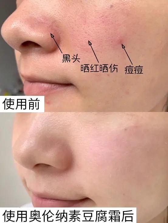 适合夏季的清爽面霜,适合夏季的清爽型面霜