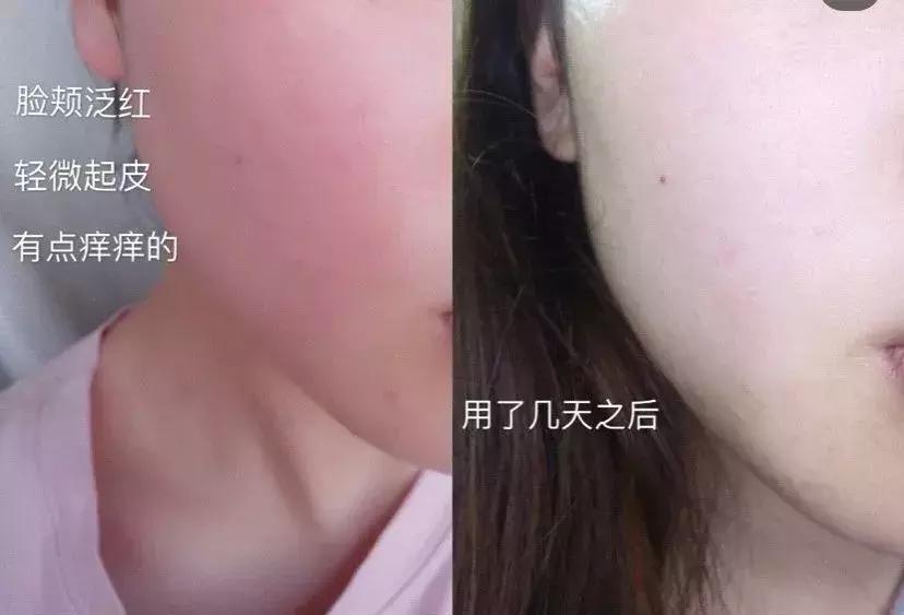 春季必备水乳在家也要好好护肤,混油皮初春水乳