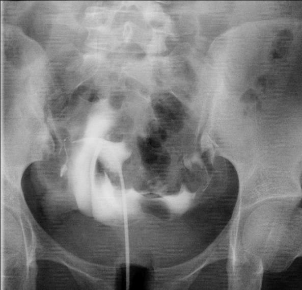 农村贫困家庭不孕治疗指南，教你用最省钱的方法快速好孕