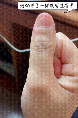 孩子十岁了没剪指甲,11岁孩子不会自己剪指甲