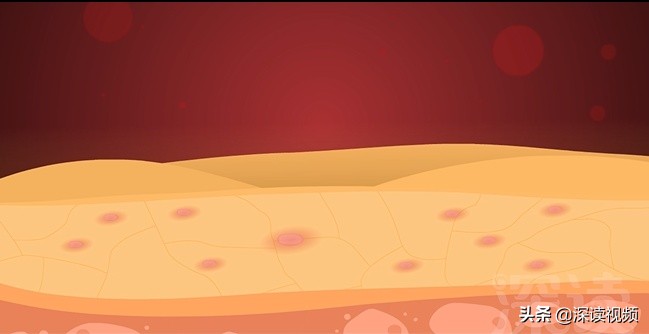 梅毒上热搜，隐私部位出现啥样要警惕？