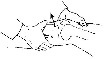 膝关节肿胀疼痛有积液怎么办？医生：5种不同情况要分别对症下药