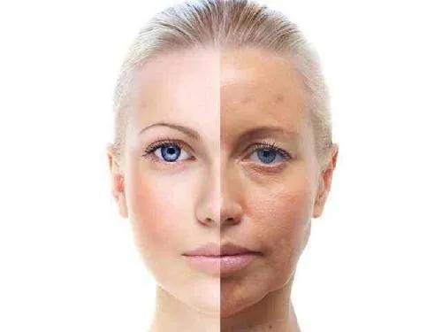 肤色暗沉去医院怎么解决,医生皮肤蜡黄暗沉怎么变白