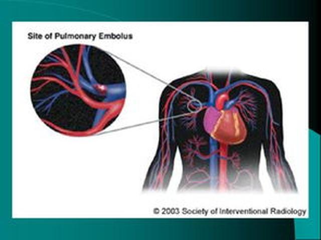 女孩不慎崴了脚,女孩崴脚