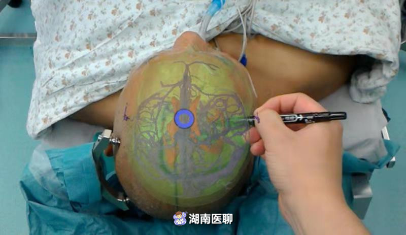 医生戴3d眼镜,医生拥有透视眼