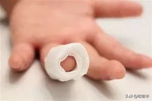 如何在家处理外伤,正确处理小外伤