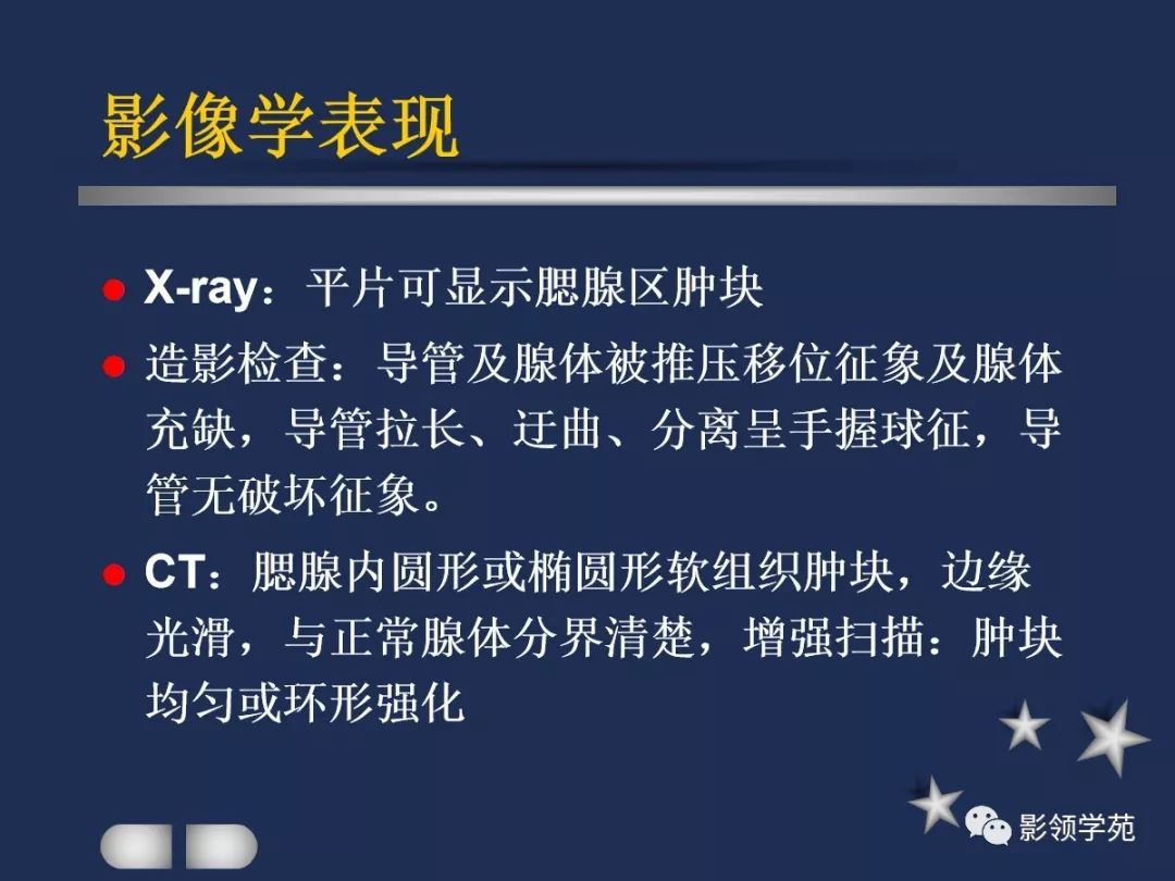 腮腺疾病影像学诊断,腮腺肿块影像诊断