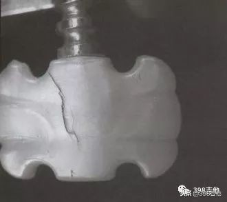 木吉他简单技巧图解,木吉他常用风格讲解