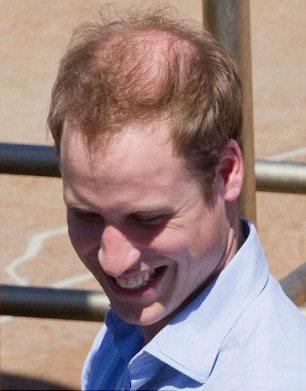 买彩有多难,买彩靠运气吗