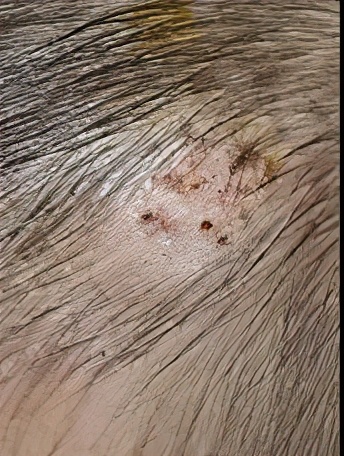 婴幼儿血管瘤的治疗「009期」董欣竞医生科普