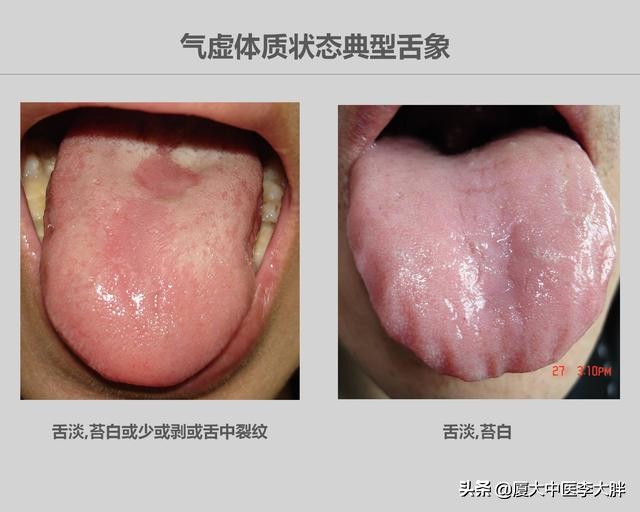 如厕蹲久了脚麻站起来头晕,蹲久了头晕脚麻是怎么回事