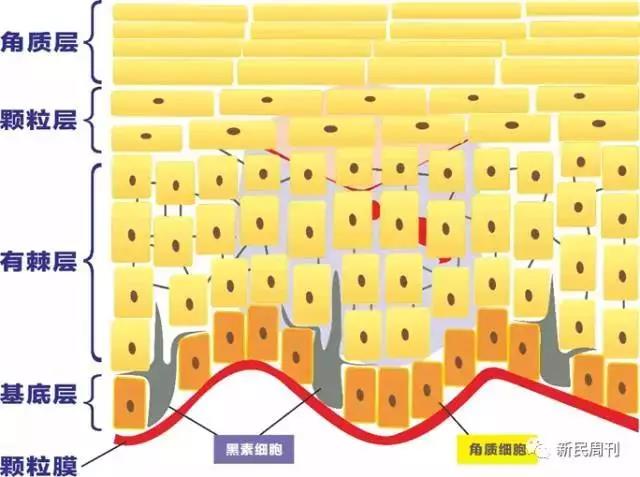 宝宝脸晒红了就是晒伤了吗,宝宝晒伤脸红了怎么快速恢复