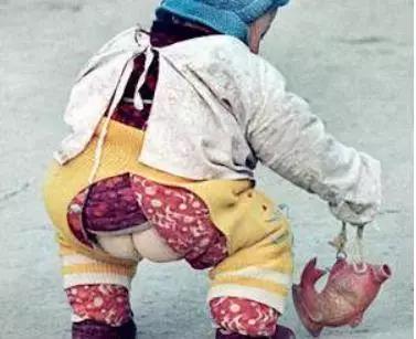 育儿陋习——开裆裤的危害