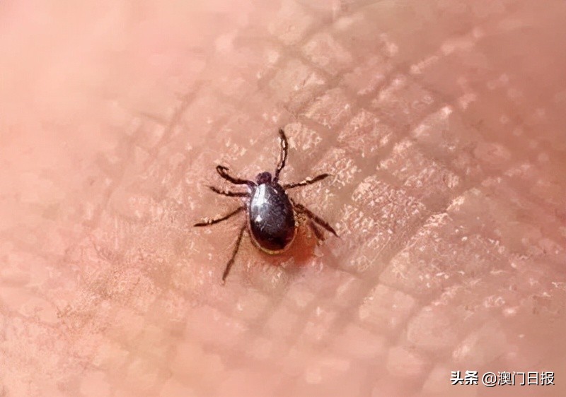 男子阴囊遭恙虫叮咬住院，曾到九澳油库钓鱼