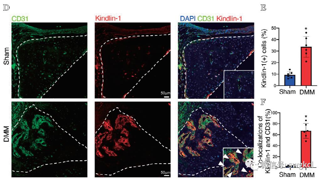 粘着斑相关蛋白Kindlin-1在血管内皮细胞的表达及功能研究