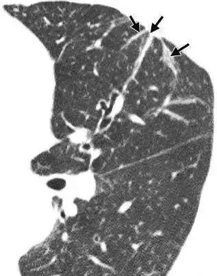 拍了片子拿到结果看不明白？彩虹医生教您看懂影像报告