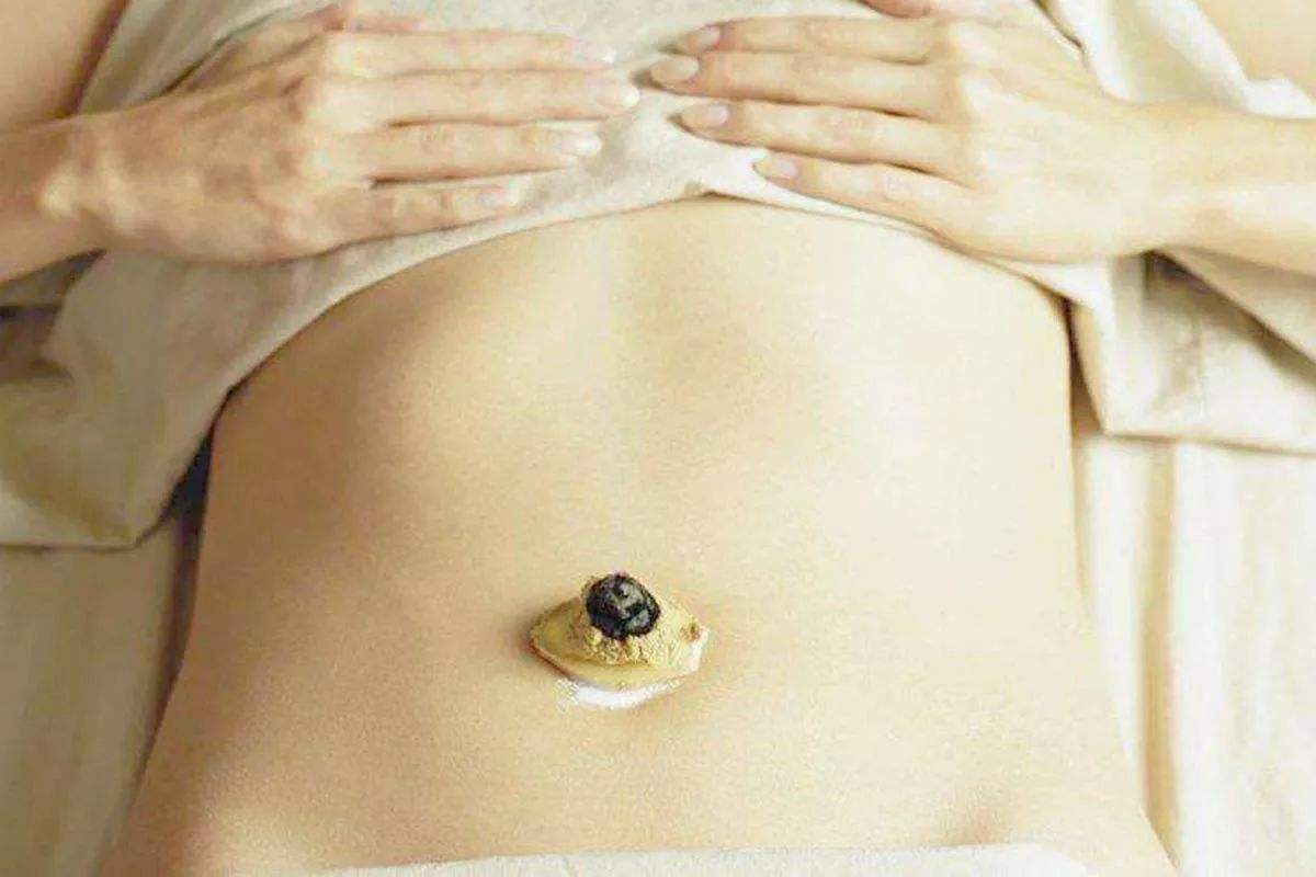 神阙穴也是人体唯一能见到的穴位,神阙内关穴