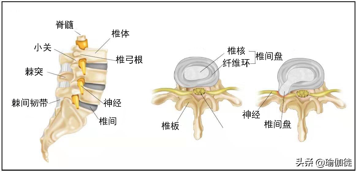 了解腰椎压力的原因吗？瑜伽轴向伸展减椎间盘压力，减压方法在这