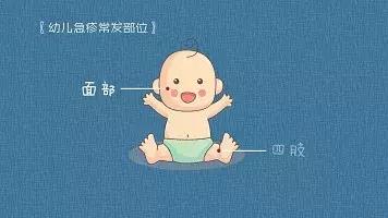 月嫂急救婴儿,月嫂宝宝护理有哪些方法