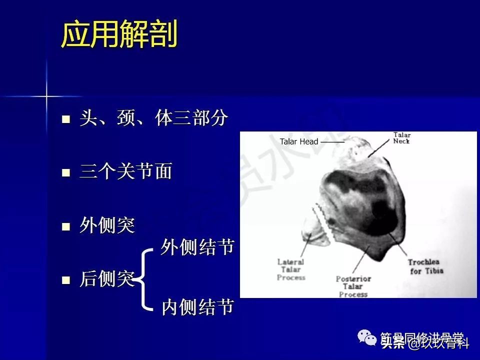 距骨骨折后遗症,距骨骨折怎么办