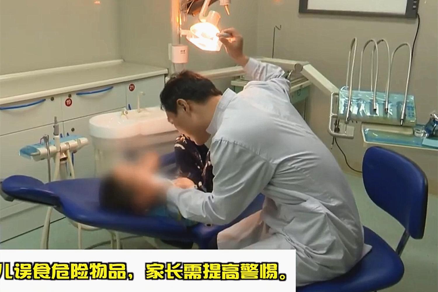 孩子误食了502强力胶,孩子误食了502强力胶吃什么药排毒