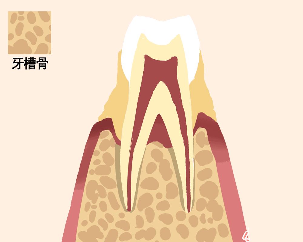 中年人牙齿松动拔了好还是脱落好,牙齿松动就拔好还是很松拔牙好