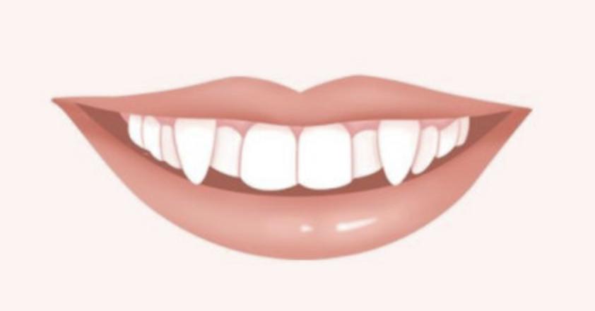 *牙虎**，少年的美好