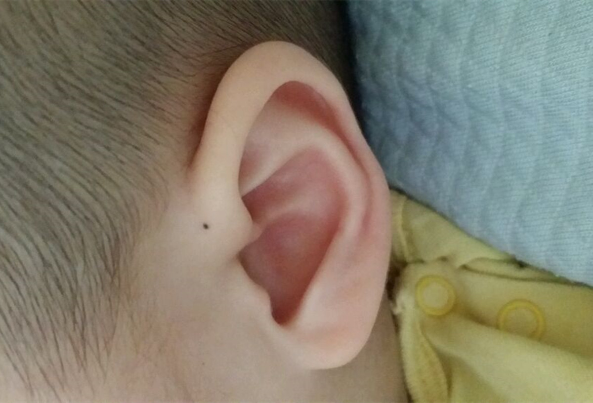 孩子耳朵里进虫子,孩子耳朵进虫子了怎么办