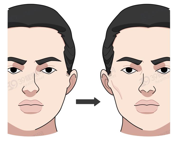 隐形牙套能矫正整齐吗,为什么戴牙套会让人变好看