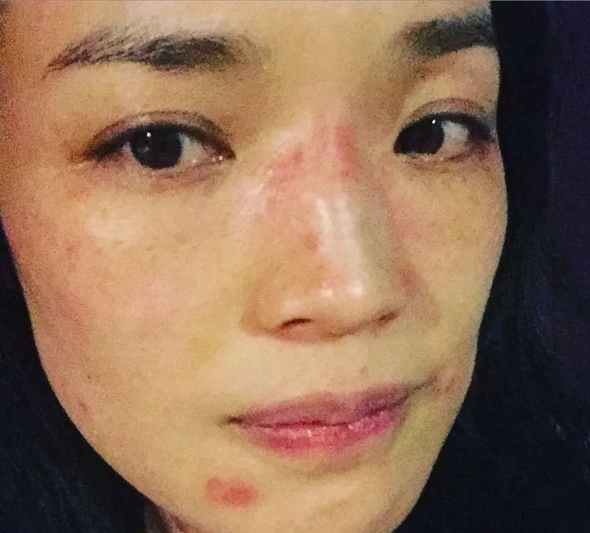 舒淇过敏都用什么护肤品呢,舒淇过敏化妆视频教程