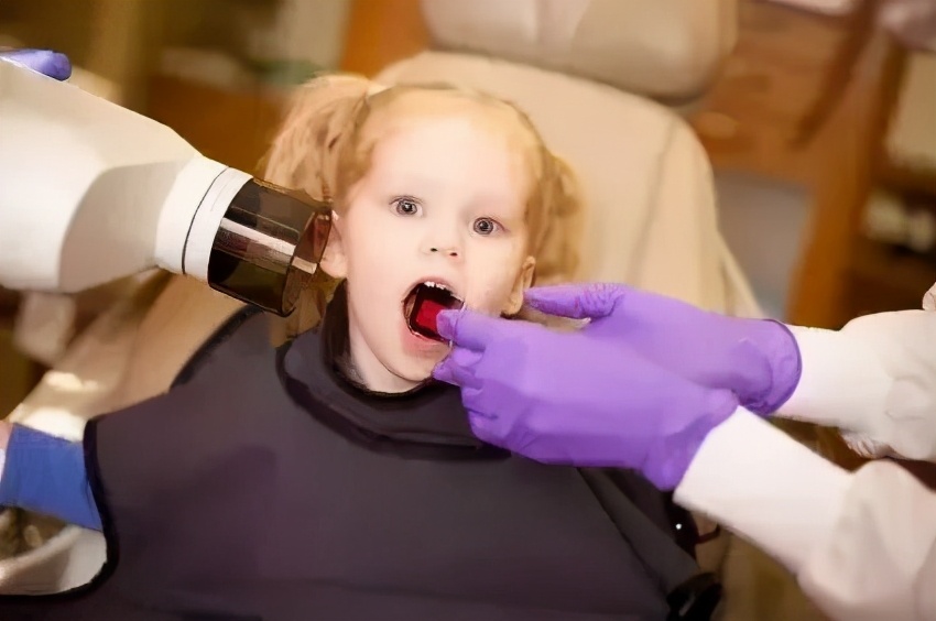 拍牙x光片对身体有什么危害,牙齿拍了几次x光片的危害