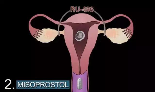 丁嘉丽明星的故事,丁嘉丽央视