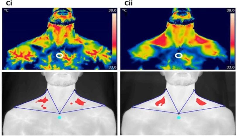 为什么喝咖啡很亢奋,喝咖啡变得特别兴奋