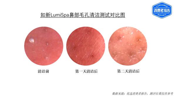 哪种洗脸清洁工具好,什么洁面皂洗脸最好测评
