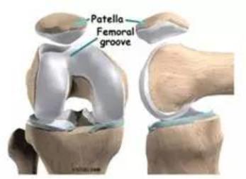 髌股疼痛综合症的评估,髌胫束综合征膝盖疼