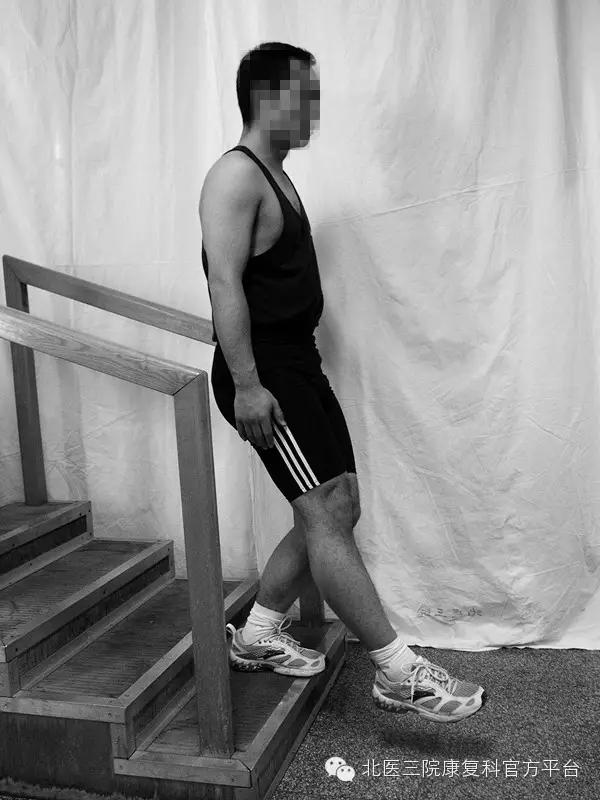 髋关节撞击综合征微创手术恢复,关节镜微创术半月板修复后康复