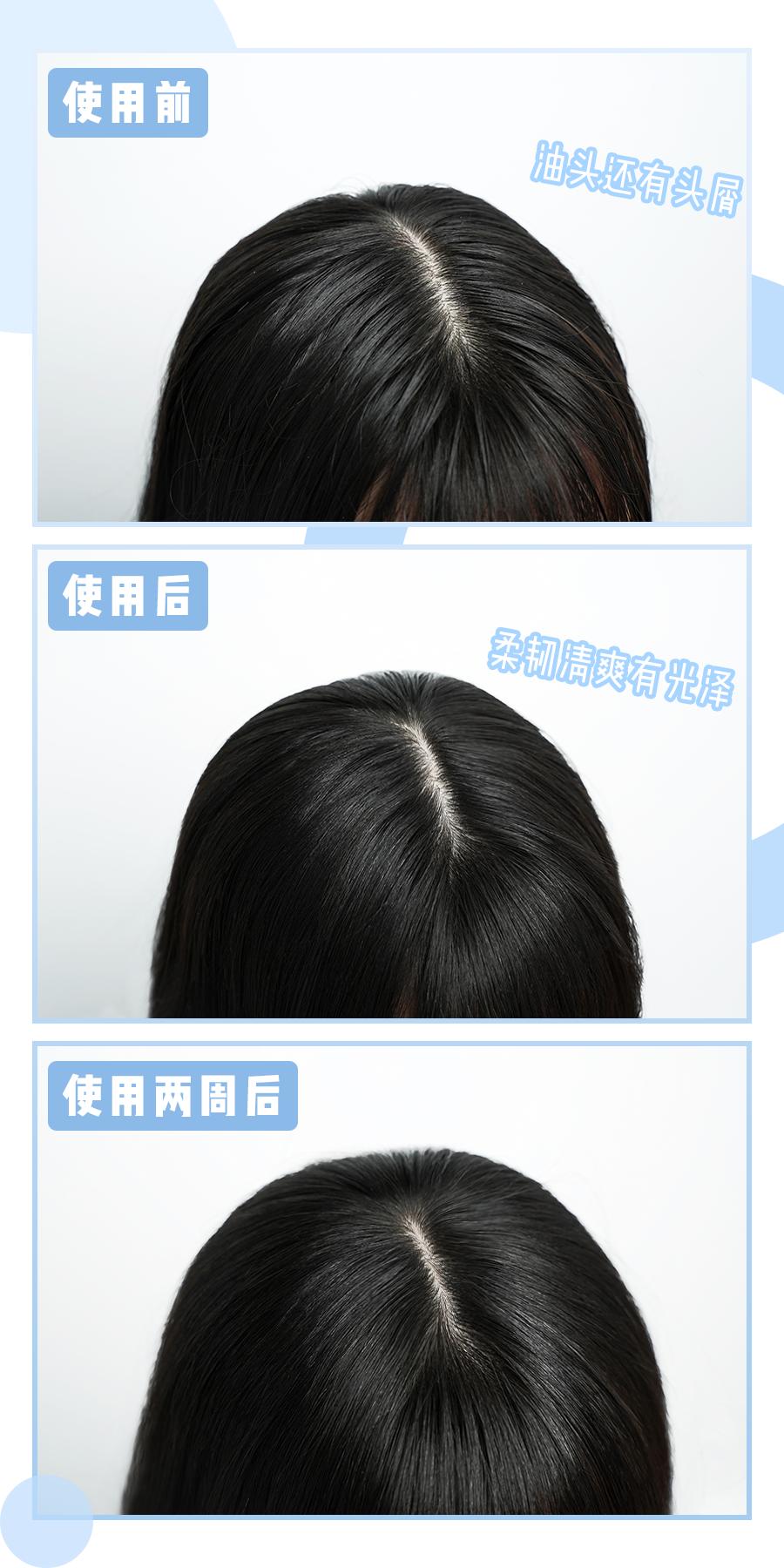 鞠婧祎全身造假,鞠婧祎头皮都整了吗