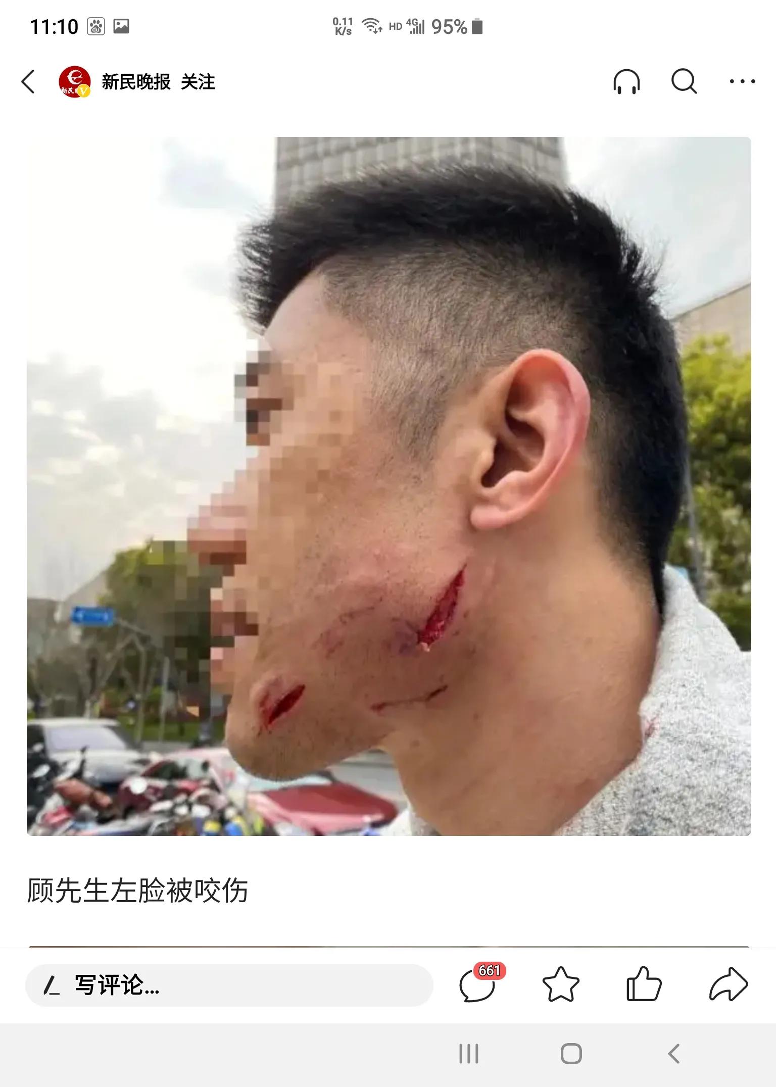 散步遇到狗怎么办,老人散步被狗咬伤