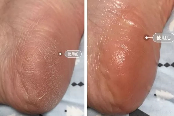 张韶涵如何抗糖,张韶涵抗老秘密