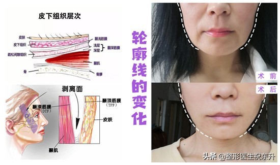 也许从一开始就错了图片,突然有了很深的法令纹