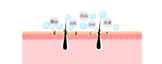 自发泡清洁黑头粉刺小气泡面膜,小气泡去黑头粉刺清洁神器好不好