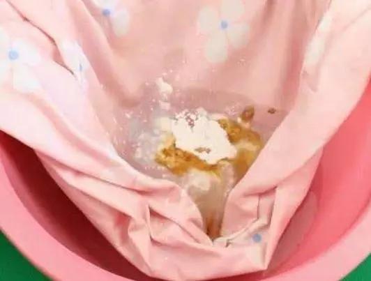 床单汗黄了用什么洗,床单汗黄怎么洗掉霉斑