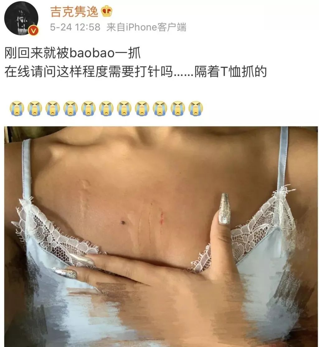 被仓鼠咬伤也要注射狂犬疫苗吗,被仓鼠抓伤了没出血要狂犬疫苗吗