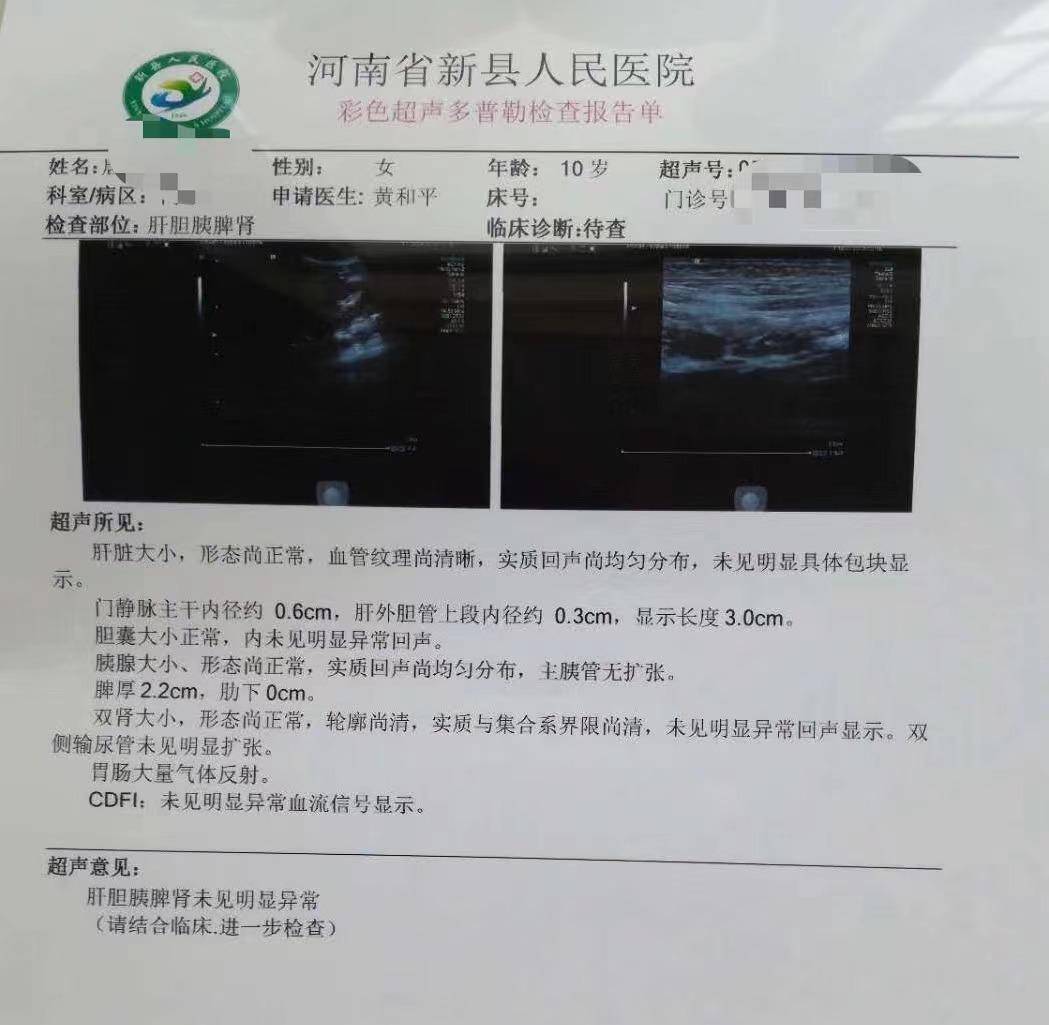 肠系膜淋巴结炎是哪里腹痛,肠系膜淋巴结炎腹痛怎么缓解