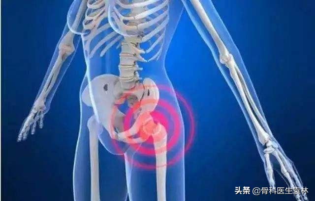 股骨头坏死最新的治疗方法,股骨头坏死的治疗方法