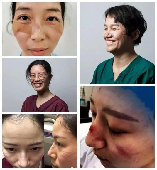 战疫女医护如何解决“闷痘”问题？希川给出这些“秘方”