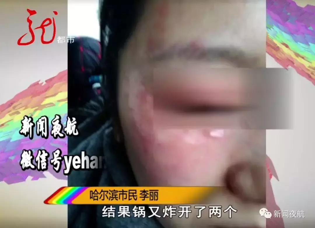 元宵炸糊了怎么办,元宵用油炸爆炸怎么回事