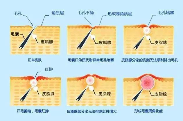 女子为变美花掉300余万后续,女子为变美脸塌陷