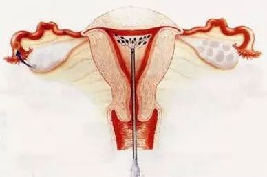 结婚多久不怀孕是不孕不育,婚后一直没怀孕就是不孕吗