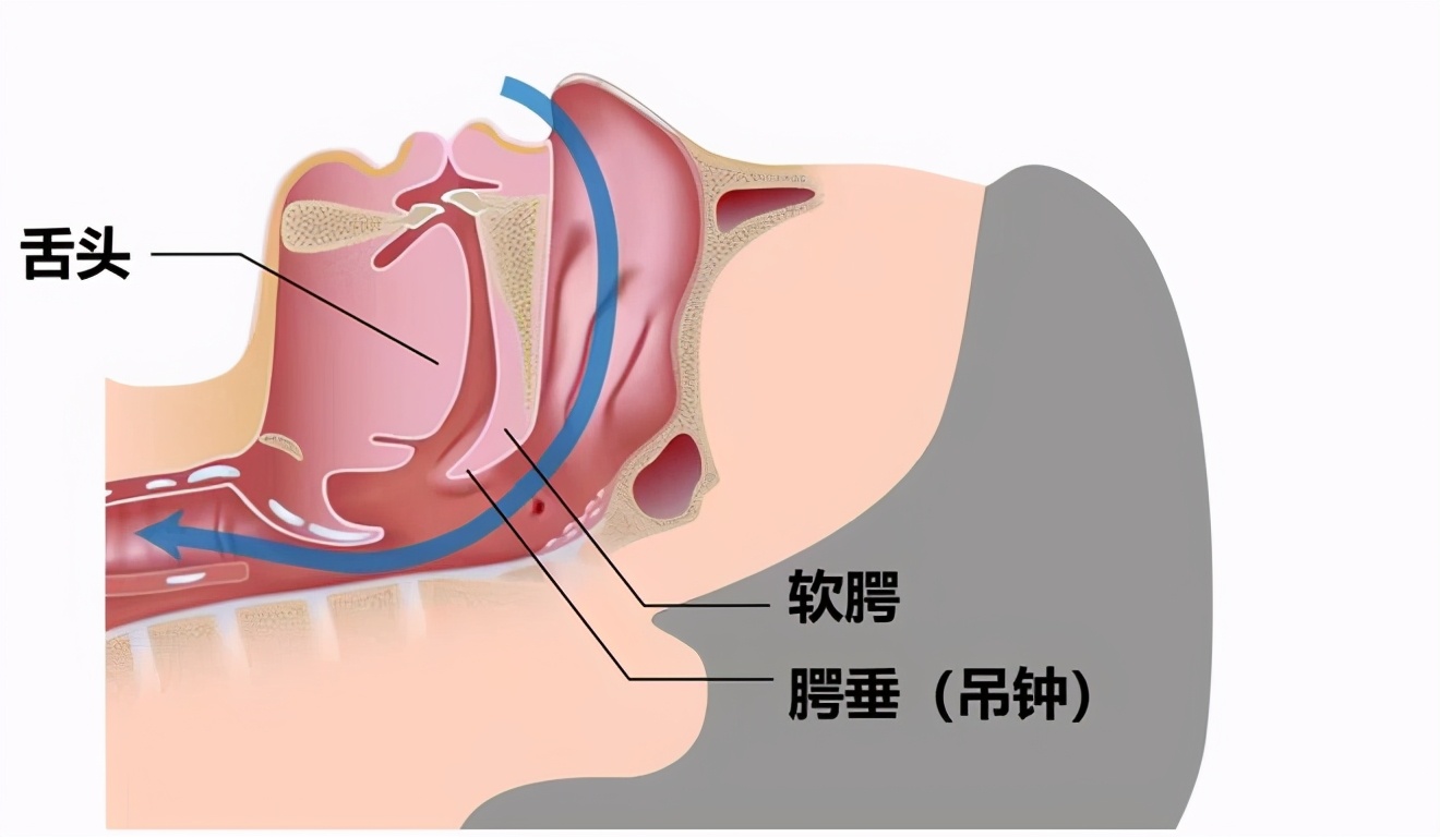 呼吸机止鼾选单水平还是双水平,止鼾呼吸机的正确使用方法